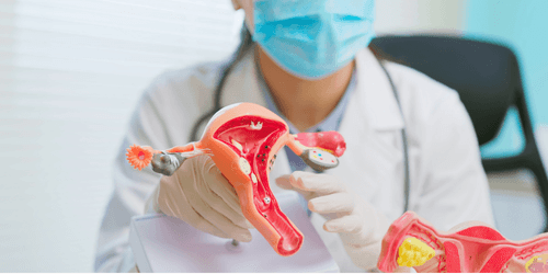 Demystifying PCOS: Your Guide to Managing the Condition